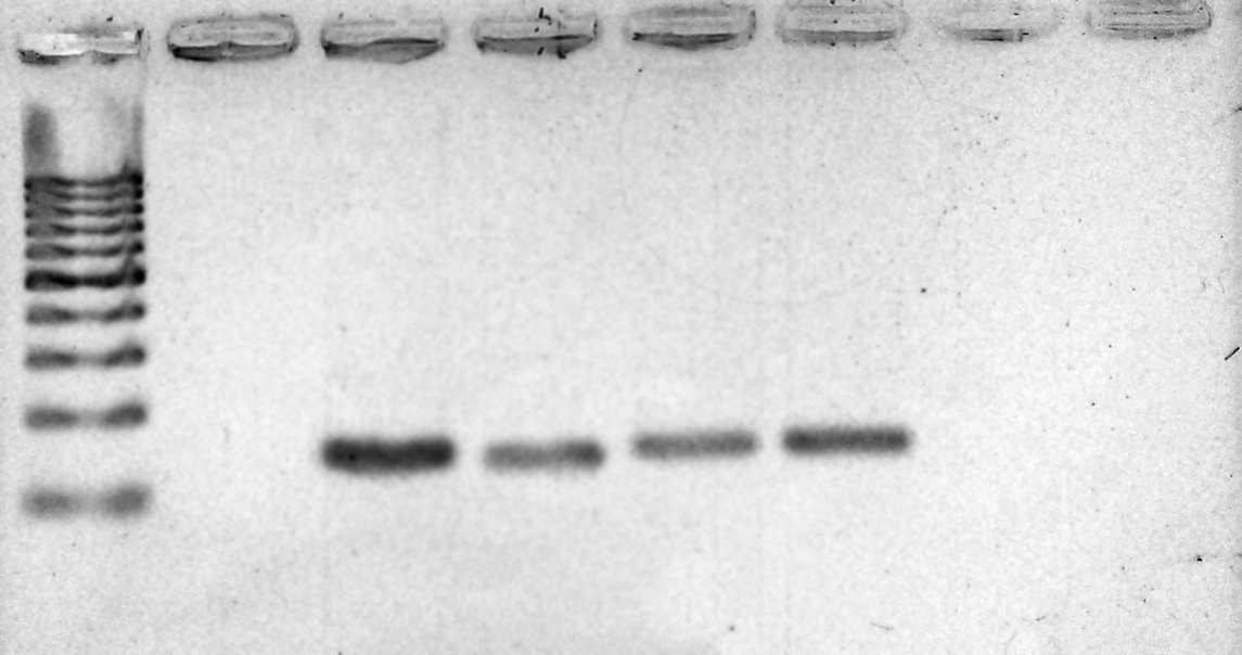 60 6.4 PCR DE SUABE CONJUNTIVAL (PCR-SC) E PCR DE SANGUE (PCR-SG) Nesta etapa realizou-se primeiro a PCR de suabe conjuntival (PCR-SC).