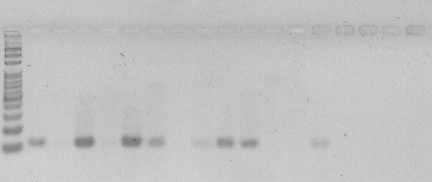 61 Figura 6 - Fragmentos obtidos pela PCR com o DNA de sangue canino. Linha 1: padrão 100pb (Invitrogen ). Linha 2: Controle positivo. Linha 18: Controle negativo.