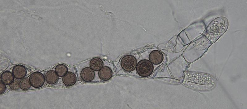 Rozella allomycis an intracellular parasite of the chytrid Allomyces sp (Blastocladiomycota fungus). (Photomicrograph from T.Y. James.