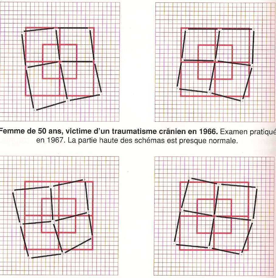 Os esquemas dos dois olhos são sensivelmente idênticos.