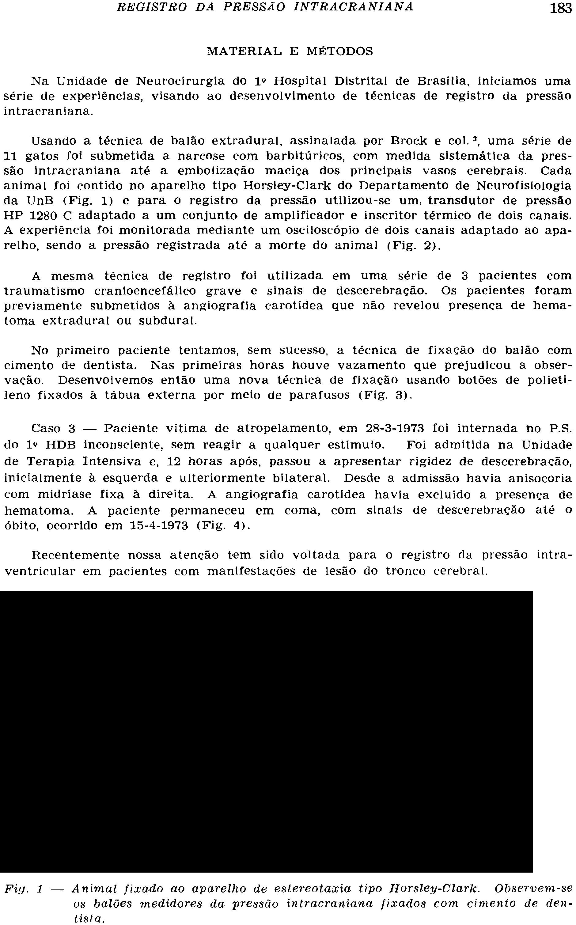 MATERIAL E MÉTODOS Na Unidade de Neurocirurgia do iv Hospital Distrital de Brasília, iniciamos uma série de experiências, visando ao desenvolvimento de técnicas de registro da pressão intracraniana.