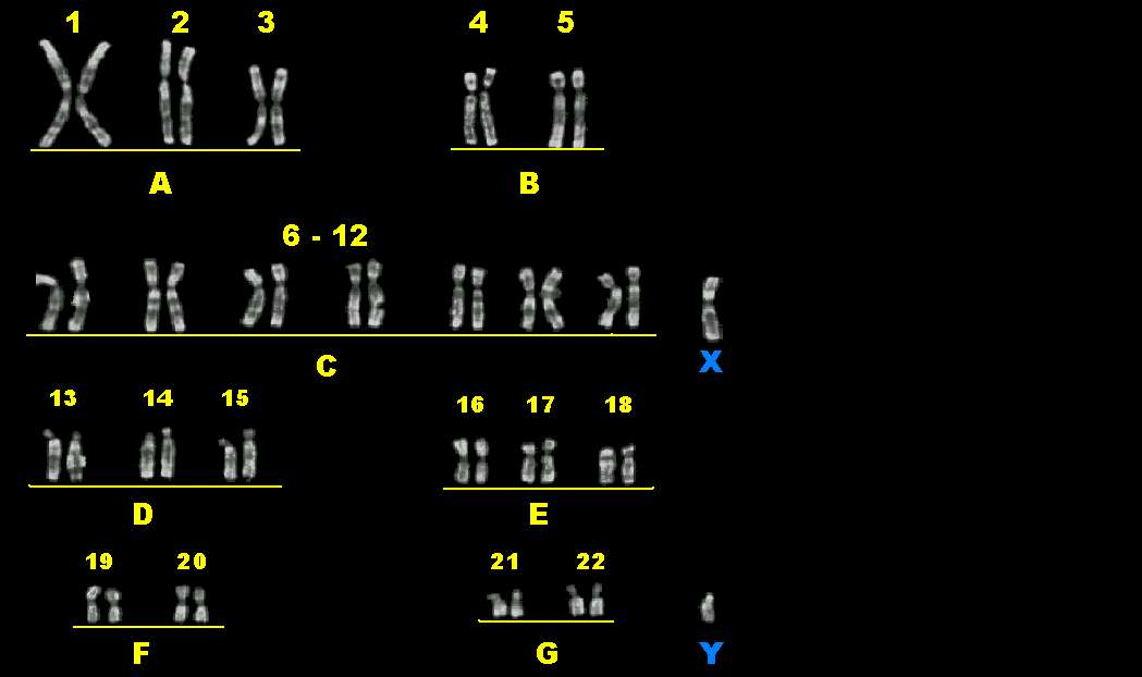 Cariograma Cromossomos