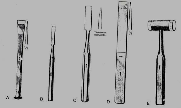 Figura 42. Diferentes tipos de osteótomos (A, B, C e D) e martelo (E) (Botucatu, 2013).