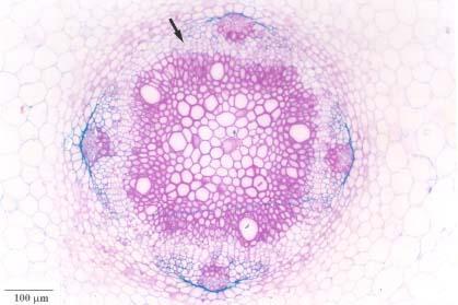 Figuras 10.9 a 10.11 - Cortes transversais da raiz de feijão (Phaseolus vulgaris) em diferentes estádios de desenvolvimento. 10.10 - Passagem da estrutura primária para a secundária.