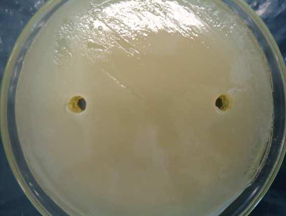 (Escherichia coli) Quanto às colônias crescidas em placas com meio MRS, notou-se na coloração de Gram que, das 10 amostras colhidas, duas apresentaram cocos gram positivos e cocos gram negativos