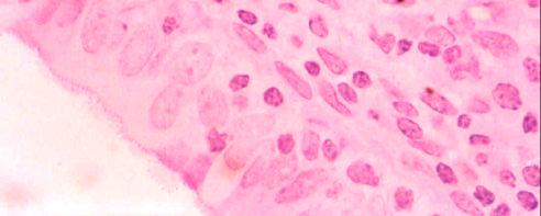 C) Células epiteliais com microvilosidades.