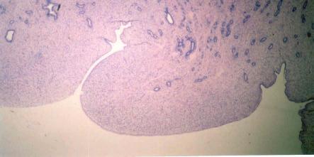 53 Figura 9: Fotomicrografia de glândulas uterinas