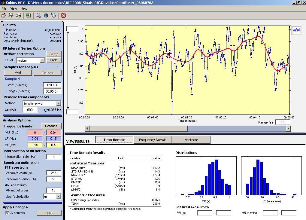 35 Figura 7: Interface do software Kubios HRV Analysis, versão 2.0. 3.4.2- Análise da VFC pré-exercício (2º. dia) e pré-controle (3º.