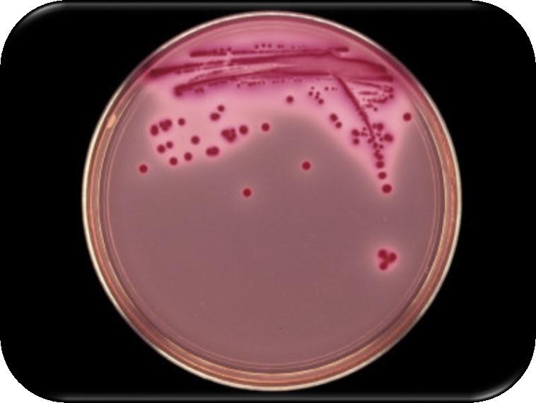 Cultivo laboratorial de microorganismos Cultura com um único micro-organismo Ausência de contaminantes