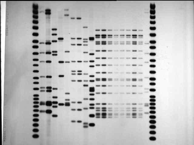 Aplicações Teste de paternidade/maternidade Identificação criminal (forense) Diagnóstico de doenças genéticas Fingerprinting genético Uso de sonda de DNA repetitivo produz uma