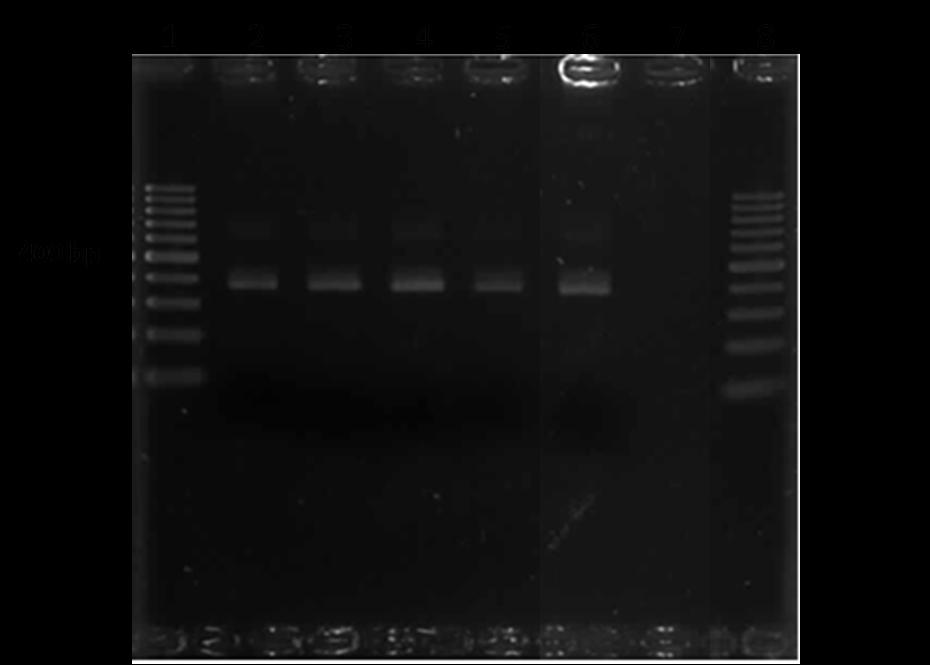 49 Figura 2 Eletroforese em gel de agarose (1,5%) dos amplicons do gene dsb de Ehrlichia