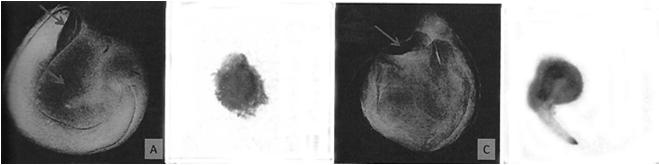 Grau de maturidade Genótipo Germinação (%) Germinação (%) Dias após o início da frutificação Alterações na germinação de sementes de soja Bragg durante a maturação (MARCOS FILHO,