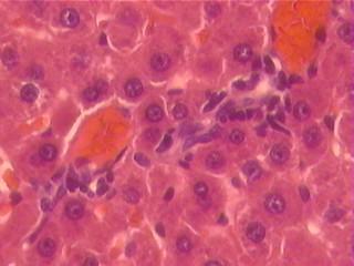 aumentado(seta) e alguns pontos de necrose (*), no grupo tratado com extrato via gavage (B); muitos hepatócitos com degeneração citoplasmática (setas) no grupo veneno(c); células.