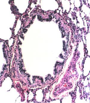 Daiene Tórgo Fabretti, Marta Silvana da Motta & Figura 9.8 - Bronquíolo e, ao redor, alvéolos e um ramo da artéria pulmonar. HE. Objetiva de 10x (137x).