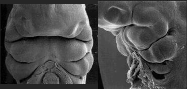 Saliência Nasal Medial Saliência Nasal Lateral Processo Maxilar