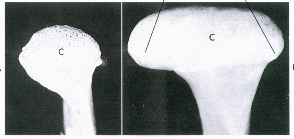 formação Camada de condroblastos (condroblastos) Cabeça do côndilo Camada degenerativa Zona de Ossificação