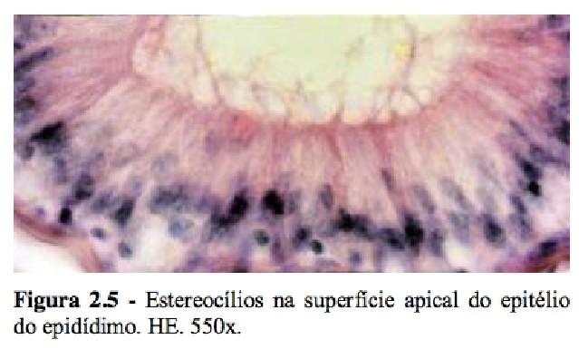Tecido Epitelial Componentes 2) ESTEREOCÍLIOS - Microvilos longos, que aumentam a superfície de