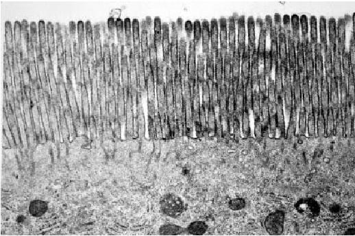 Tecido Epitelial As superfícies apical ou basolateral das células epiteliais podem apresentar ESPECIALIZAÇÕES (para melhor desempenho de suas funções) 1)