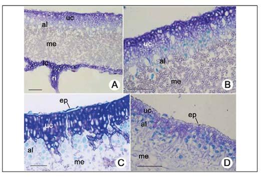 Protistas, Fungos e Vegetais Inferiores Figura 15. A. Punctelia secção transversal do talo mostrando córtex superior, camada de alga, medula com arranjo frouxo de hifas, córtex inferior e rizina. B.