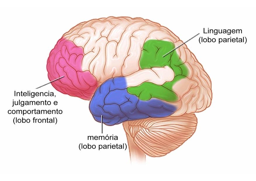 Figura 1: Regiões do cérebro afetadas pela Doença de Alzheimer.