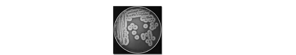 CULTIVO: MEIOS DE CULTURA Meios de Cultivo Diferencial Utilizado para a fácil identificação da colônia da bactéria de interesse quando existem outras bactérias crescendo