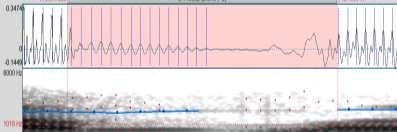 Sound pressure level (db/hz) Sound pressure level (db/hz) Sound pressure level (db/hz) Sound pressure level (db/hz) V.