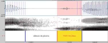 espectrograma e segmentação, exemplificando em (a) o VOT(-) dos segmentos plosivos vozeados, em (b) o VOT(0)