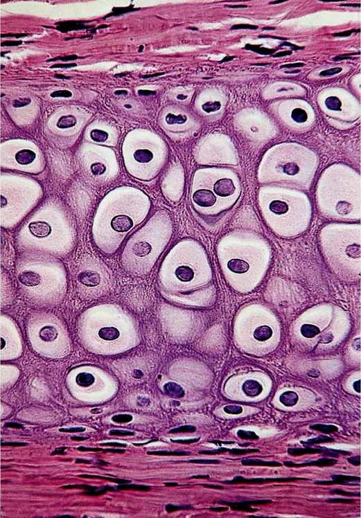 Cartilagem hialina Os condrócitos citos estão localizados nas lacunas da matriz.