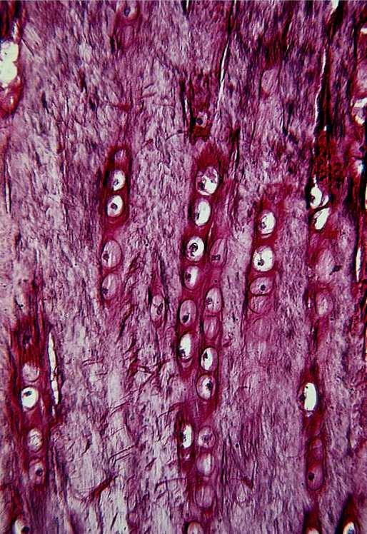 Fibrocartilagem Notar as fileiras de condrócitos