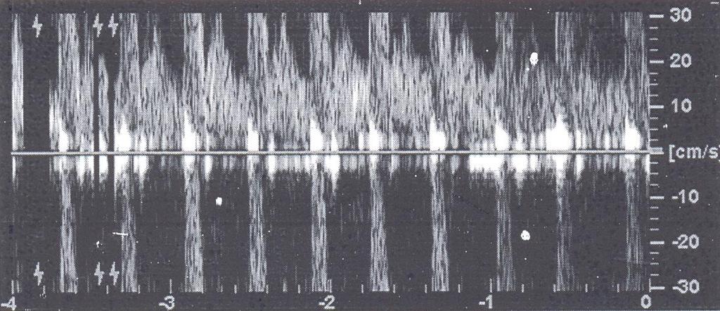 876 Carvalho et al. e aparece erroneamente no lado oposto da linha de base como uma continuação do espectro propriamente dito (Figura 2) (CERRI et al., 1998).
