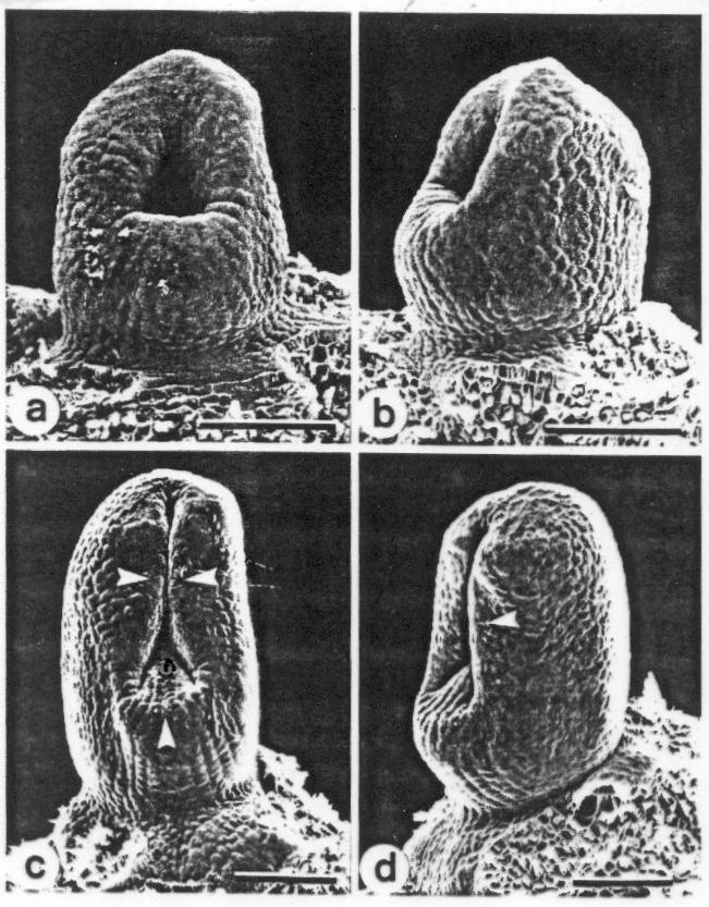 ANGIOSPERMIA Fechamento carpelar em Laurus nobilis