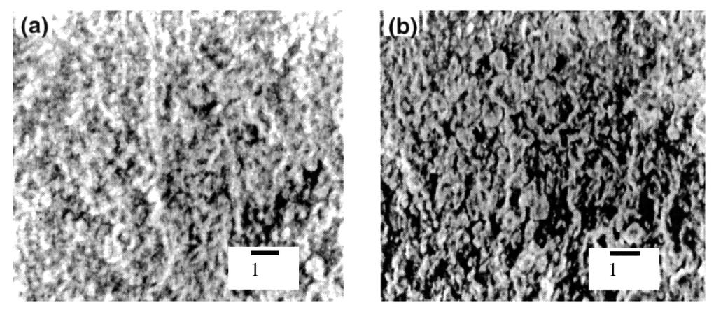 Figura 2: Fotomicrografias eletrônicas de varredura: (a) recobrimento; (b) suporte. Aumento 7000x.