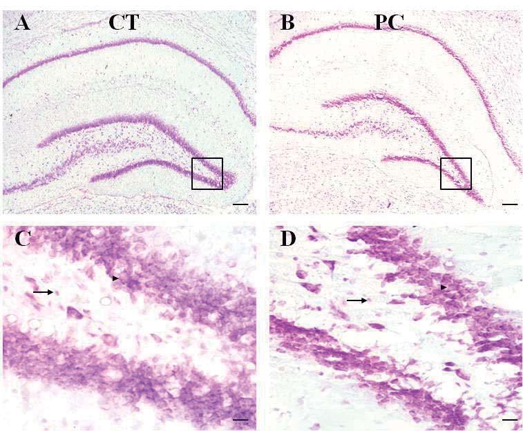 Paralisia Cerebral e Cognição C 8 D 8 E 8 Neurônios no CeA 6 4 2 Neurônios no BLA 6 4 2 Média de células no giro denteado 6 4 2 *** E 15 Células da Glia no CeA 1 5 F 15 Células da Glia no BLA 1 5