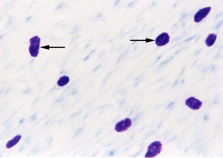 Mastócitos Origem: precursor da medula óssea Função: grânulos contêm mediadores químicos que