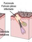 Glândula Sebácea produz o sebo: