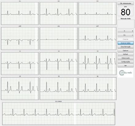 Capturar um Exame Essa é a principal função do sistema. Depois de ter iniciado o processo para buscar o aparelho CW-12, o botão Iniciar Coleta será habilitado.