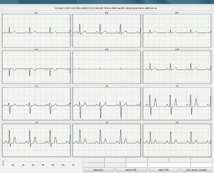 médico que laudou, o sistema automaticamente solicita a senha do médico que laudou o exame.