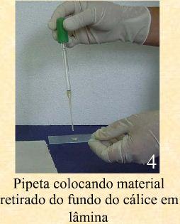 6- Retirar o sedimento com uma pipeta Pasteur.