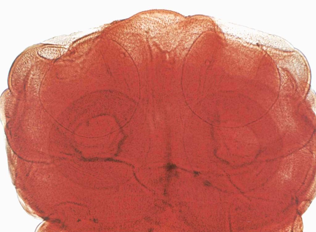 excrementos humanos inacessíveis aos hospedeiros intermediários,