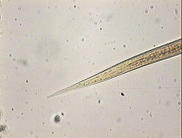 1: Larva Rabditoide 100x; 2: Fêmea de vida livre 50x;