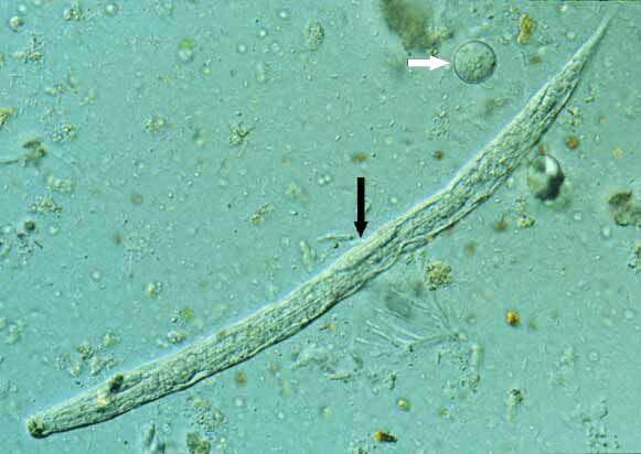 100x; 5: Larva filarioide, extremidade posterior