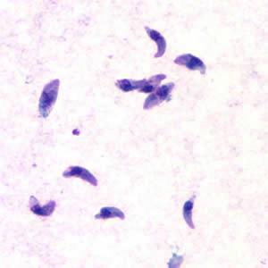 Principais parasitos humanos de transmissão hídrica ou por alimentos pesquisa de anticorpos dos tipos IgM e IgG utilizando os métodos de Imunofluorescência Indireta ou ELISA.