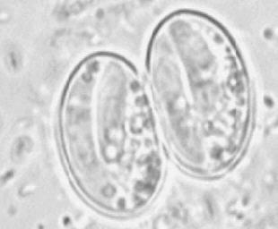 histolica 1000x Cisto Giardia duodenalis 1000x Cisto Sarcocystis sp 1000x Oocisto maduro Isospora beli 1000x