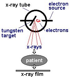 RAIO X Technologia absorção de raio x pelo corpo humano Resultado Projeção das diferentes densidades dos diversos órgãos em um plano Muito bom para Ossos,