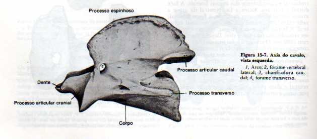 nas cervicais Duas primeiras distintas Altas e Axis As demais são