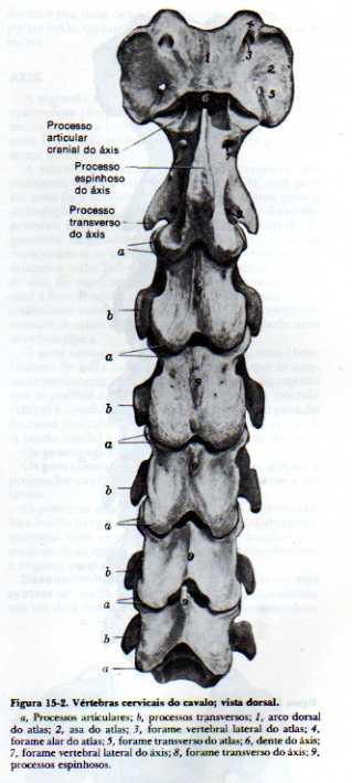 transversos grandes VÉRTEBRAS CERVICAIS ATLAS Primeira cervical -