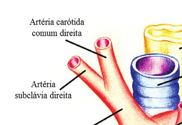 Vila Verde AG, Braga AC, Gonçalves DR, Galvão AR, Rodrigues SP, Macedo JF, Rodrigues MC ARSA é identificada ao nível do corte transversal/axial do arco aórtico (abaixo da posição da artéria subclávia