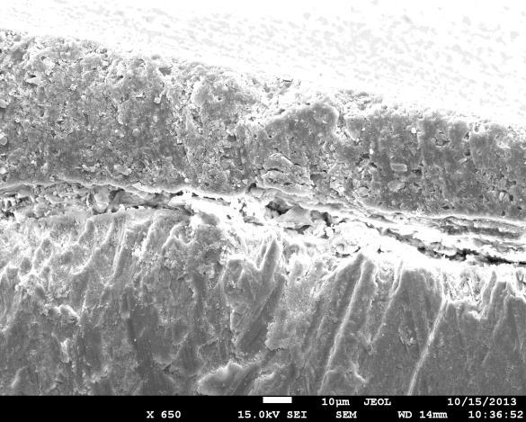 (Grupo 2) na superfície do esmalte (seta vermelha) Os selantes avaliados por meio de microscopia eletrônica de varredura apresentaram 80% ST, 20% SP, 0% A para