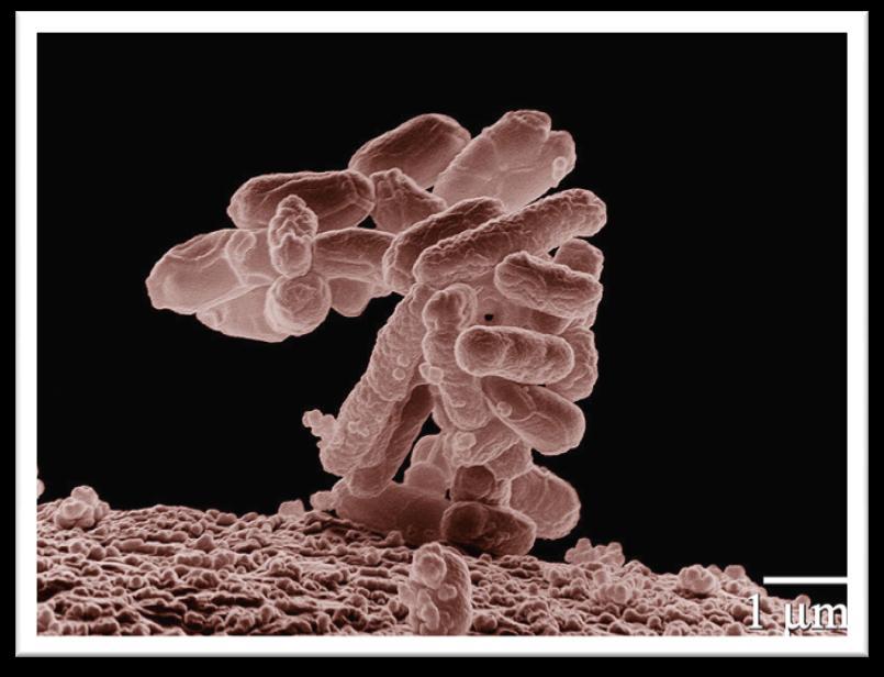 Escherichia coli As bactérias presentes nas águas e esgotos podem transmitir