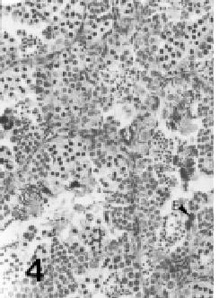 654 COSTA et al. Células da linhagem espermatogênica Espermatogônias Estas são as primeiras células da linhagem espermatogênica (Figuras 2 a 6).
